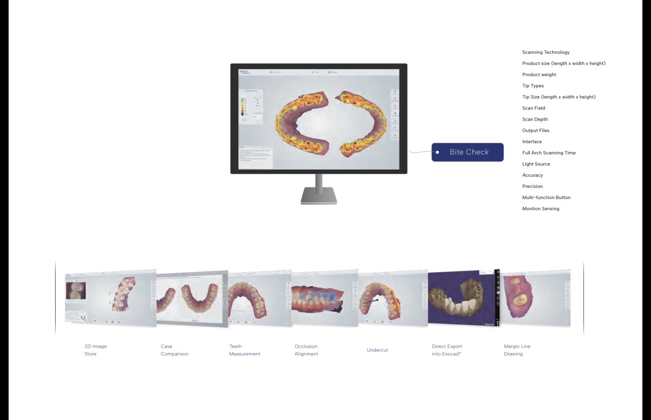 Interfaz del software de escaneo y ejemplos de visualización de modelos dentales